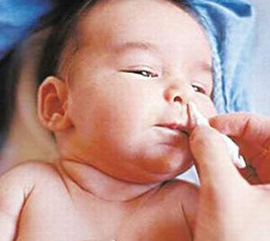 2、3个月宝宝鼻塞不需去医院
